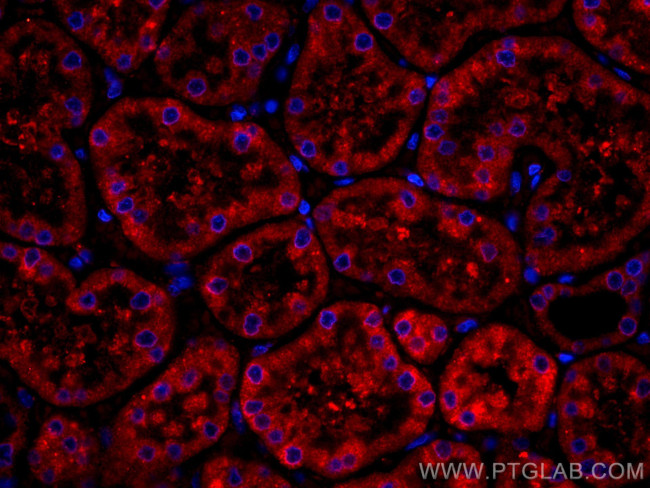 BBS5 Antibody in Immunohistochemistry (Paraffin) (IHC (P))