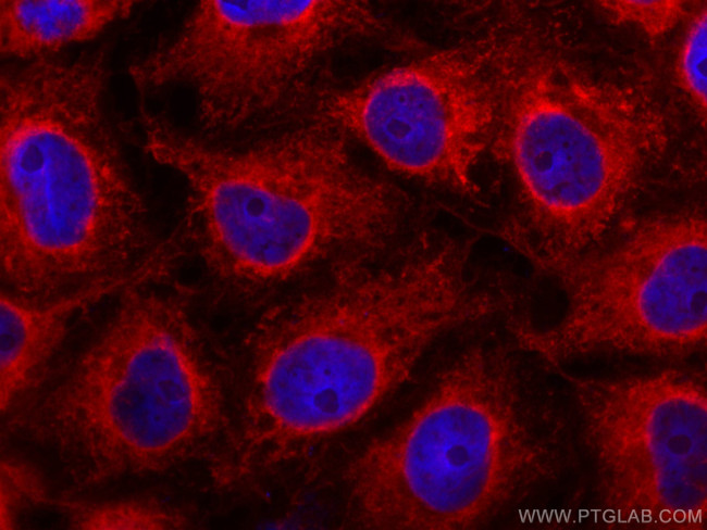 C9orf72 Antibody in Immunocytochemistry (ICC/IF)