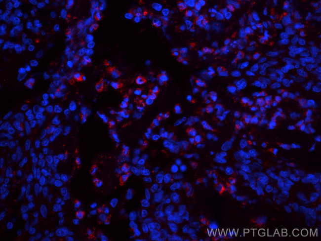 IL-9 Antibody in Immunohistochemistry (Paraffin) (IHC (P))