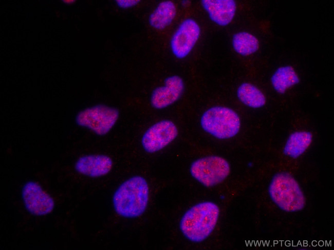 TBP Antibody in Immunocytochemistry (ICC/IF)