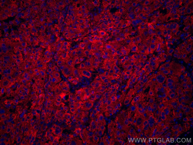 Transferrin Antibody in Immunohistochemistry (Paraffin) (IHC (P))