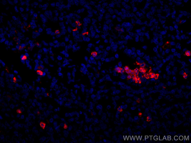 MPO Antibody in Immunohistochemistry (Paraffin) (IHC (P))