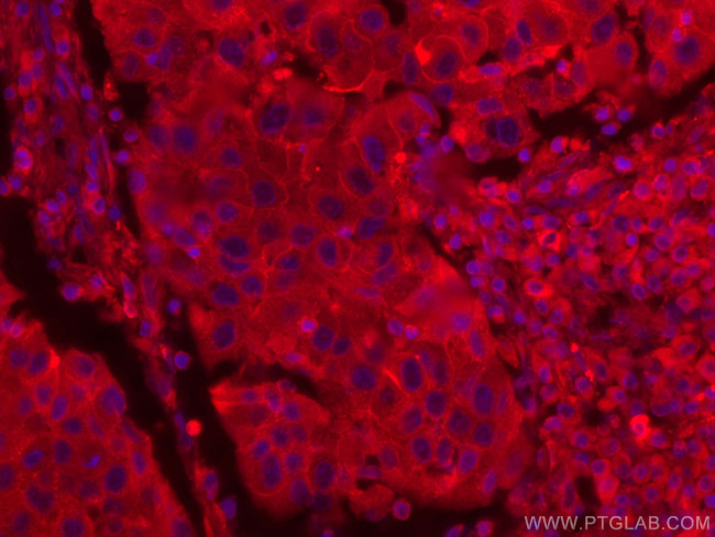 CD71 Antibody in Immunohistochemistry (Paraffin) (IHC (P))