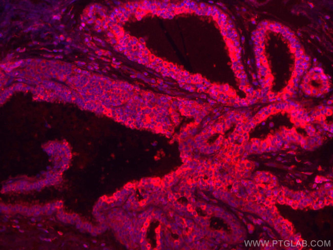 CD71 Antibody in Immunohistochemistry (Paraffin) (IHC (P))