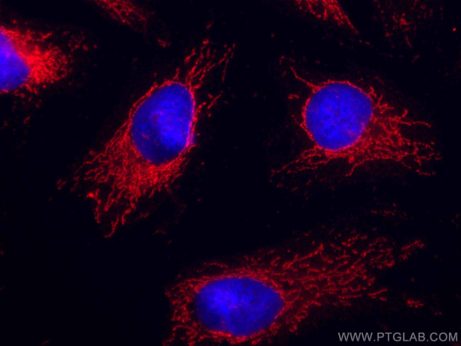 VAPB Antibody in Immunocytochemistry (ICC/IF)