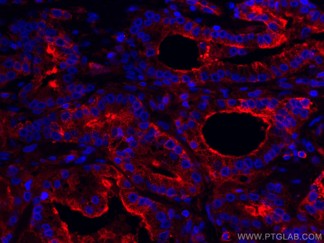 Beta-2-Microglobulin Antibody in Immunohistochemistry (Paraffin) (IHC (P))