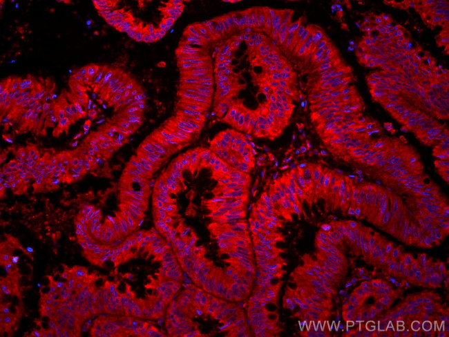 ST6GALNAC6 Antibody in Immunohistochemistry (Paraffin) (IHC (P))