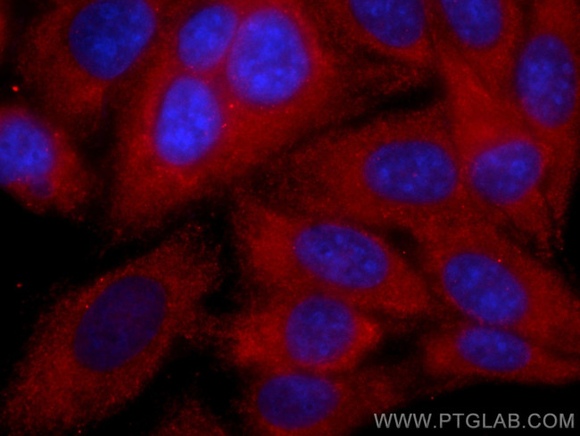 APOD Antibody in Immunocytochemistry (ICC/IF)