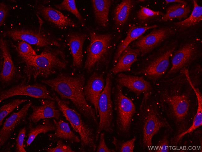 APOD Antibody in Immunocytochemistry (ICC/IF)