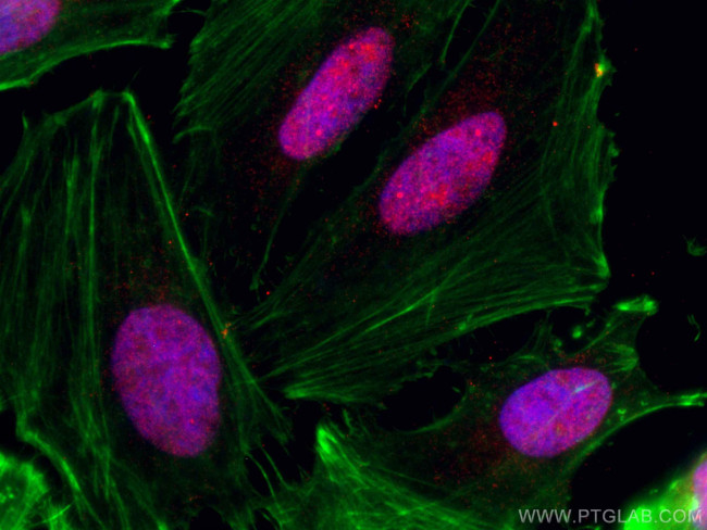 CHD4 Antibody in Immunocytochemistry (ICC/IF)