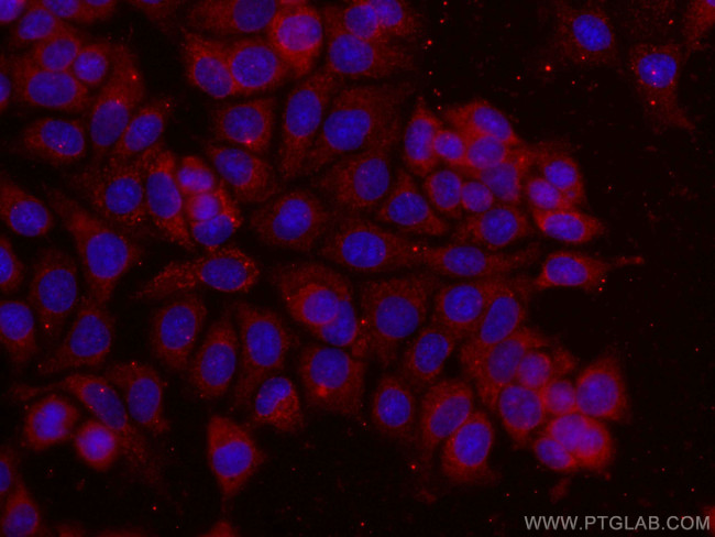 14-3-3 Sigma Antibody in Immunocytochemistry (ICC/IF)