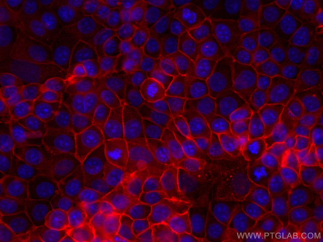 GNAS Antibody in Immunocytochemistry (ICC/IF)