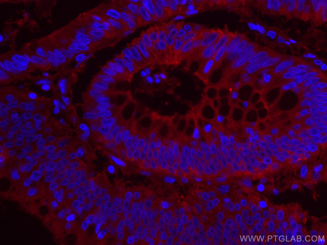 GNAS Antibody in Immunohistochemistry (Paraffin) (IHC (P))