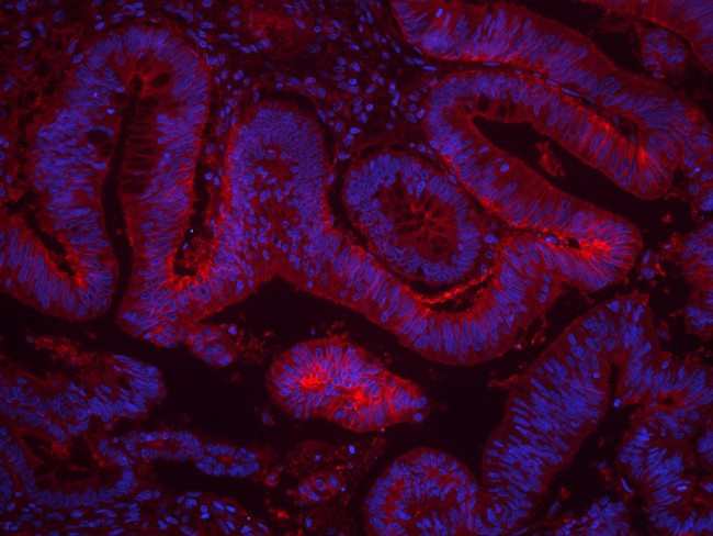 GNAS Antibody in Immunohistochemistry (Paraffin) (IHC (P))