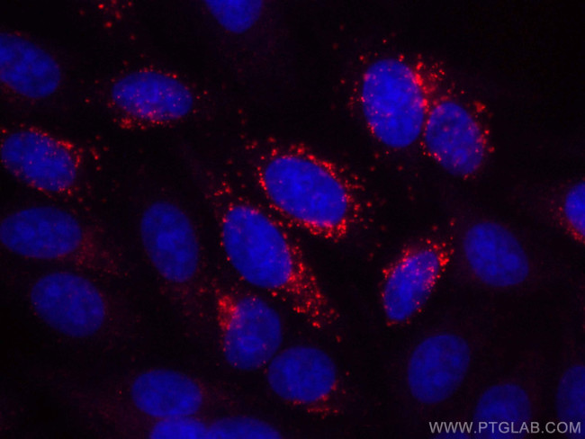 Alpha 1B-Glycoprotein Antibody in Immunocytochemistry (ICC/IF)