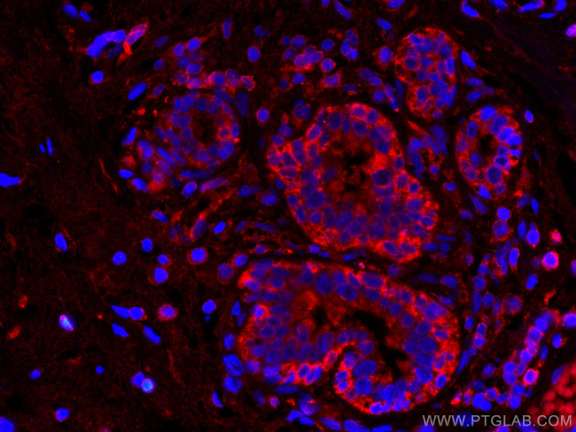 L2HGDH Antibody in Immunohistochemistry (Paraffin) (IHC (P))