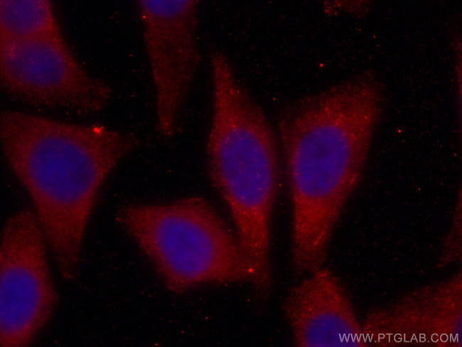 D2HGDH Antibody in Immunocytochemistry (ICC/IF)