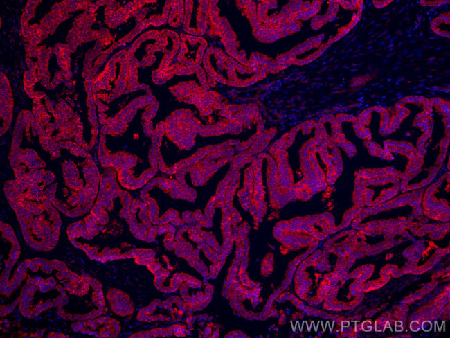 PGRMC1 Antibody in Immunohistochemistry (Paraffin) (IHC (P))