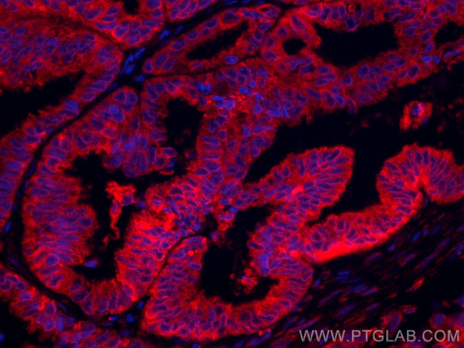 PGRMC1 Antibody in Immunohistochemistry (Paraffin) (IHC (P))