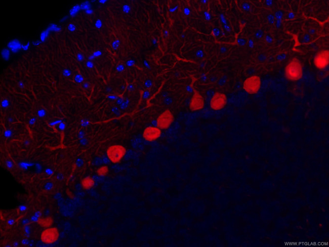 Calbindin-D28k Antibody in Immunohistochemistry (Paraffin) (IHC (P))