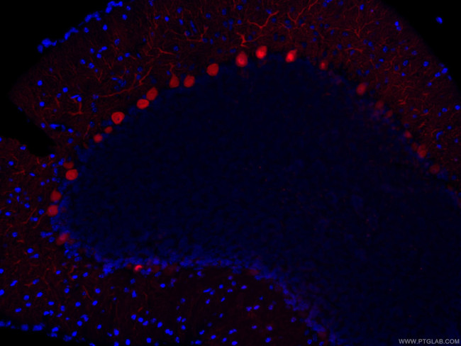 Calbindin-D28k Antibody in Immunohistochemistry (Paraffin) (IHC (P))