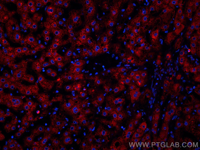 Plasminogen Antibody in Immunohistochemistry (Paraffin) (IHC (P))