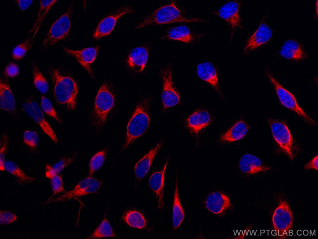 LAP3 Antibody in Immunocytochemistry (ICC/IF)