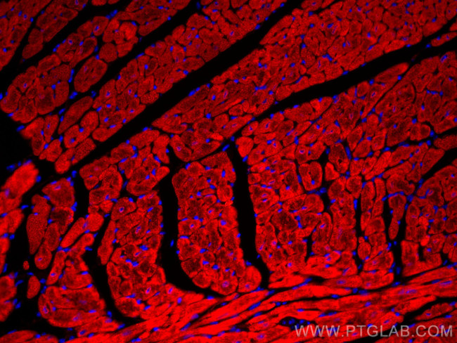 Calsequestrin 2 Antibody in Immunohistochemistry (Paraffin) (IHC (P))