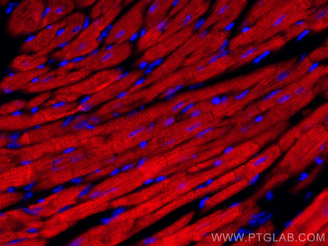 Calsequestrin 2 Antibody in Immunohistochemistry (Paraffin) (IHC (P))