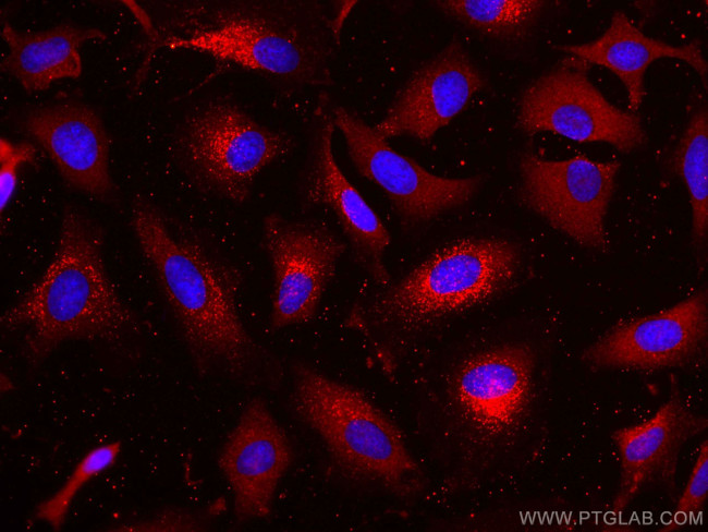 LDHB Antibody in Immunocytochemistry (ICC/IF)