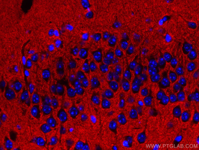 Syntaxin 1A/Syntaxin 1B Antibody in Immunohistochemistry (Paraffin) (IHC (P))