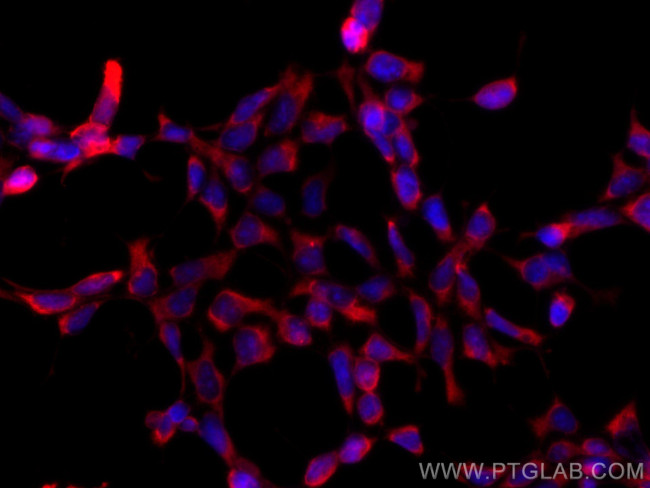 Hsc70 Antibody in Immunocytochemistry (ICC/IF)