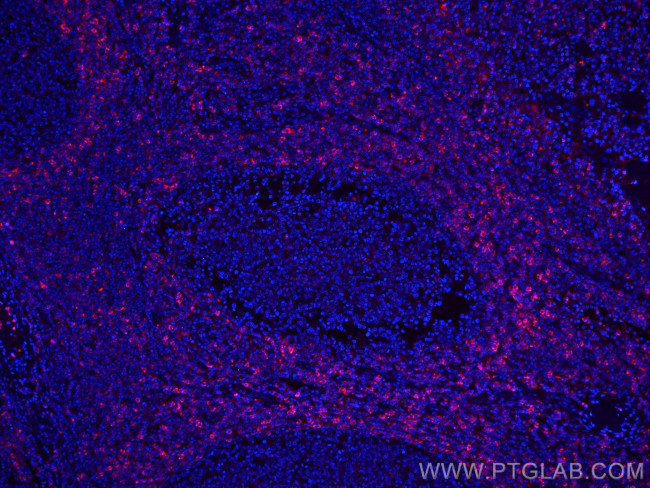 HVCN1 Antibody in Immunohistochemistry (Paraffin) (IHC (P))