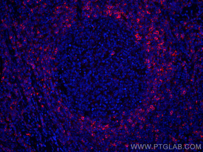 HVCN1 Antibody in Immunohistochemistry (Paraffin) (IHC (P))