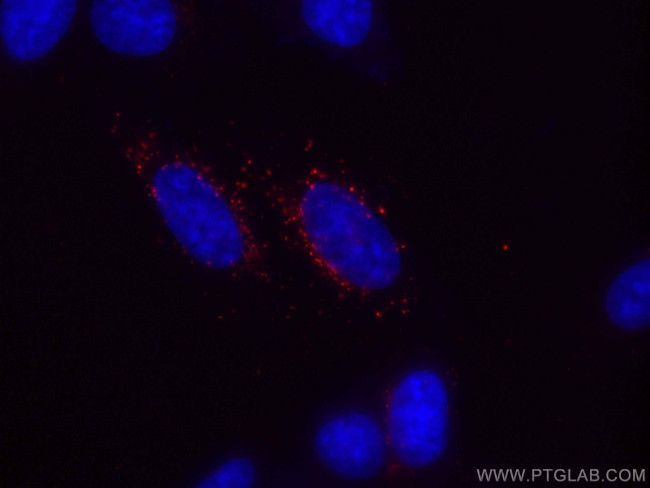 GABARAPL1 Antibody in Immunocytochemistry (ICC/IF)