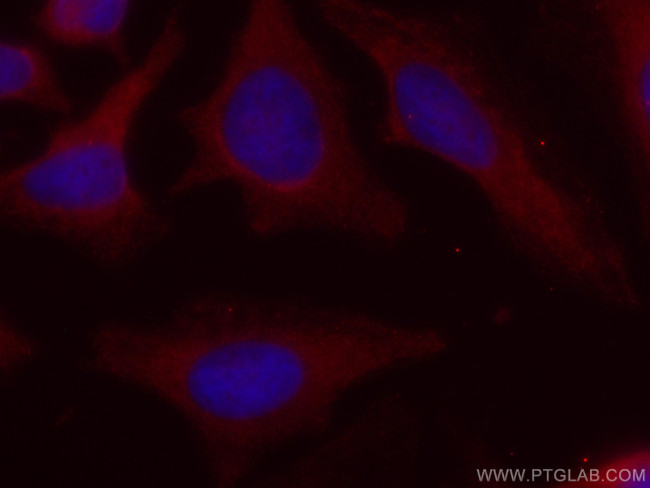 IKBKG Antibody in Immunocytochemistry (ICC/IF)