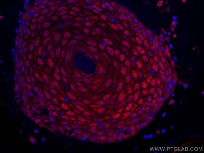 CRABP2 Antibody in Immunohistochemistry (Paraffin) (IHC (P))