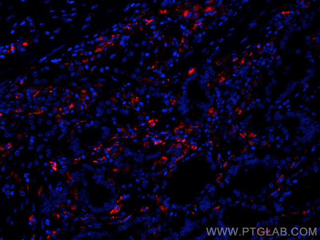 PSAP Antibody in Immunohistochemistry (Paraffin) (IHC (P))