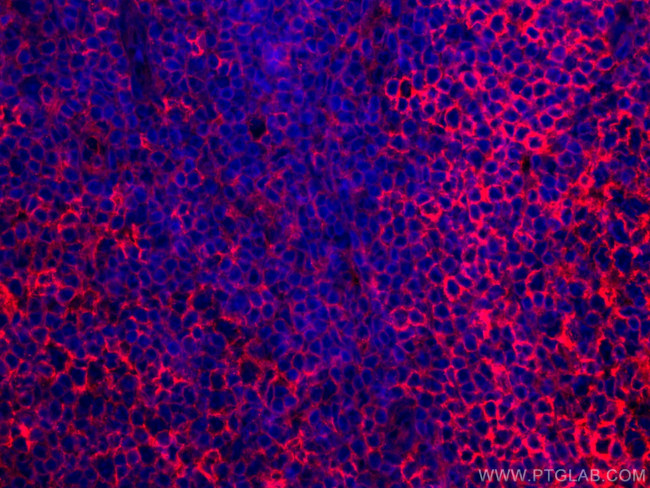 HLA-E Antibody in Immunohistochemistry (Paraffin) (IHC (P))