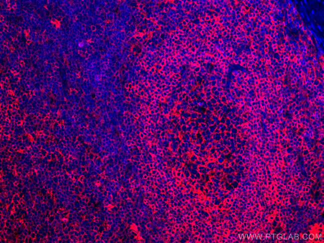 HLA-E Antibody in Immunohistochemistry (Paraffin) (IHC (P))