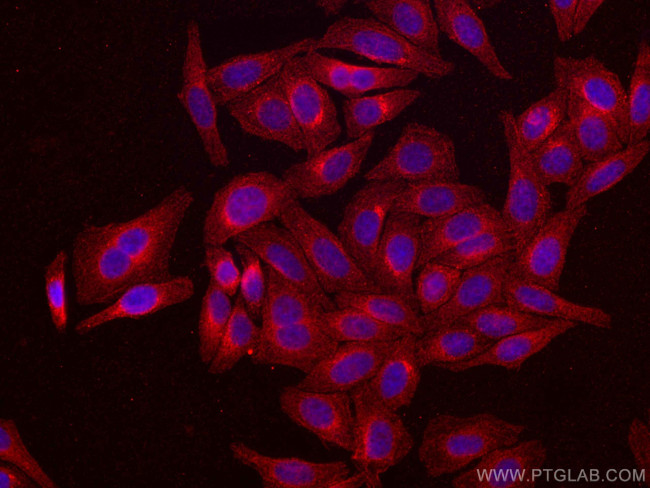 ATF6 Antibody in Immunocytochemistry (ICC/IF)