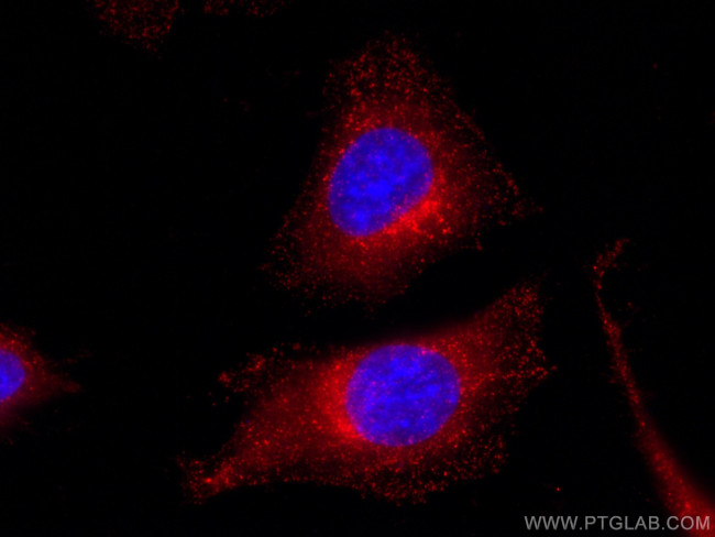 WBP2 Antibody in Immunocytochemistry (ICC/IF)