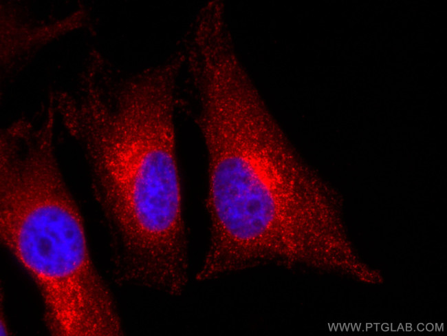 WBP2 Antibody in Immunocytochemistry (ICC/IF)