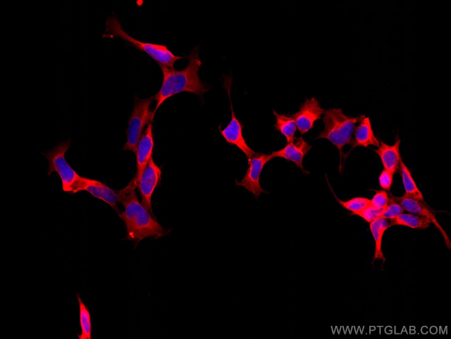 PHD2/EGLN1 Antibody in Immunocytochemistry (ICC/IF)