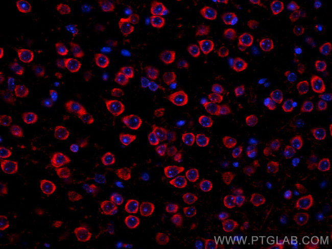 RIC8A Antibody in Immunohistochemistry (Paraffin) (IHC (P))