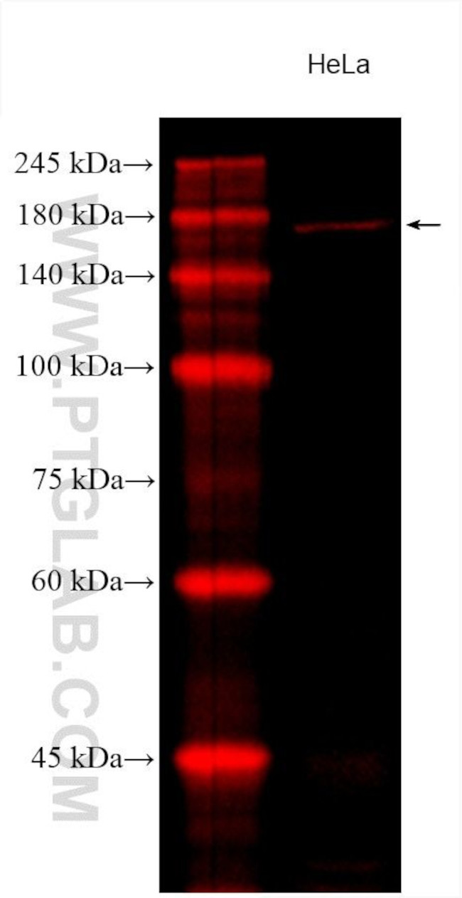 ROCK2 Antibody in Western Blot (WB)