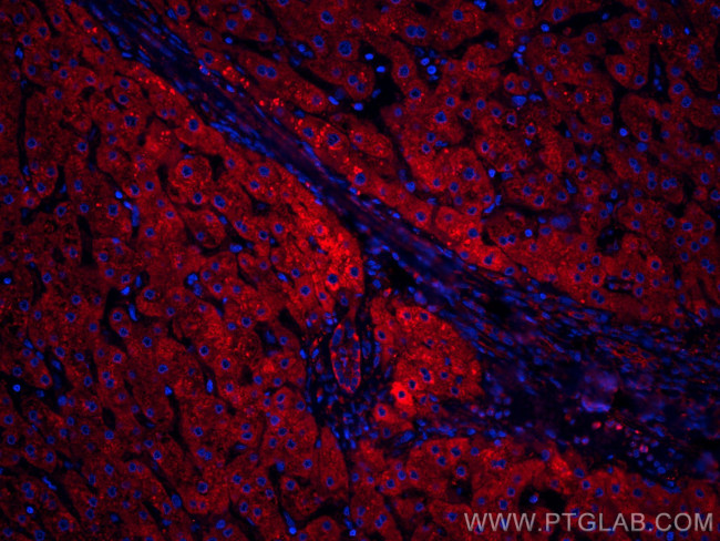 ANGPTL8 Antibody in Immunohistochemistry (Paraffin) (IHC (P))