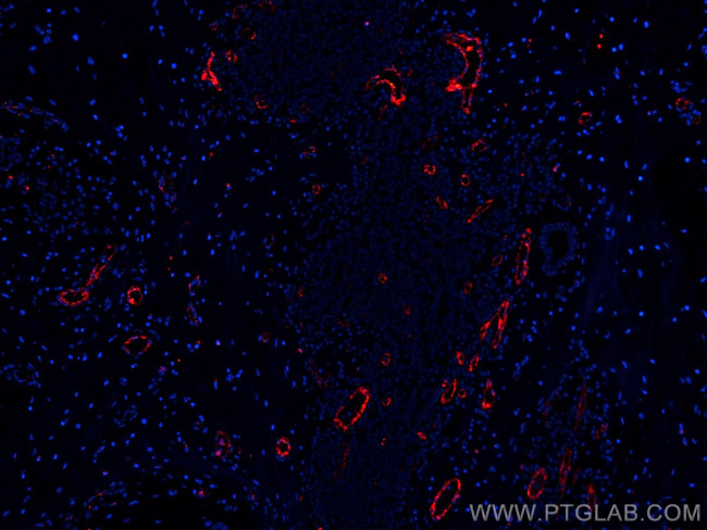 vwf Antibody in Immunohistochemistry (Paraffin) (IHC (P))