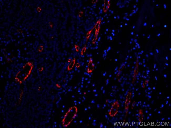 vwf Antibody in Immunohistochemistry (Paraffin) (IHC (P))