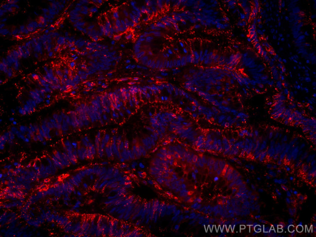 Galectin-4 Antibody in Immunohistochemistry (Paraffin) (IHC (P))